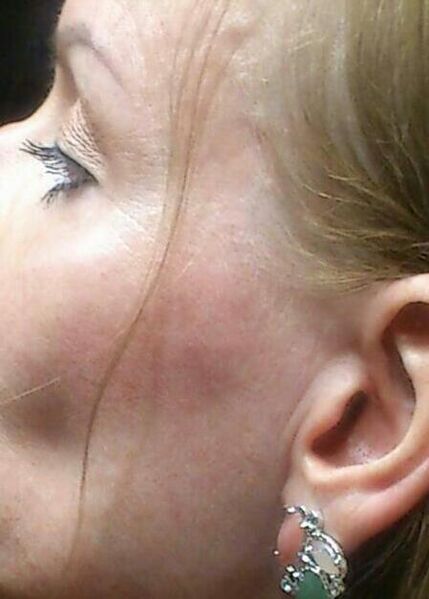 Massage kann ja auch mal schön sein, .... +4917636904610 Berlin erotic massage